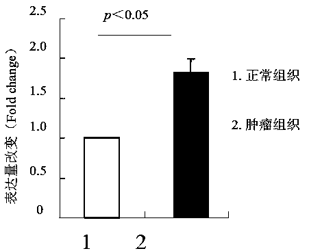 Biomarker long-chain non-coding RNA LINC02447 and kit for predicting prognosis of colon cancer