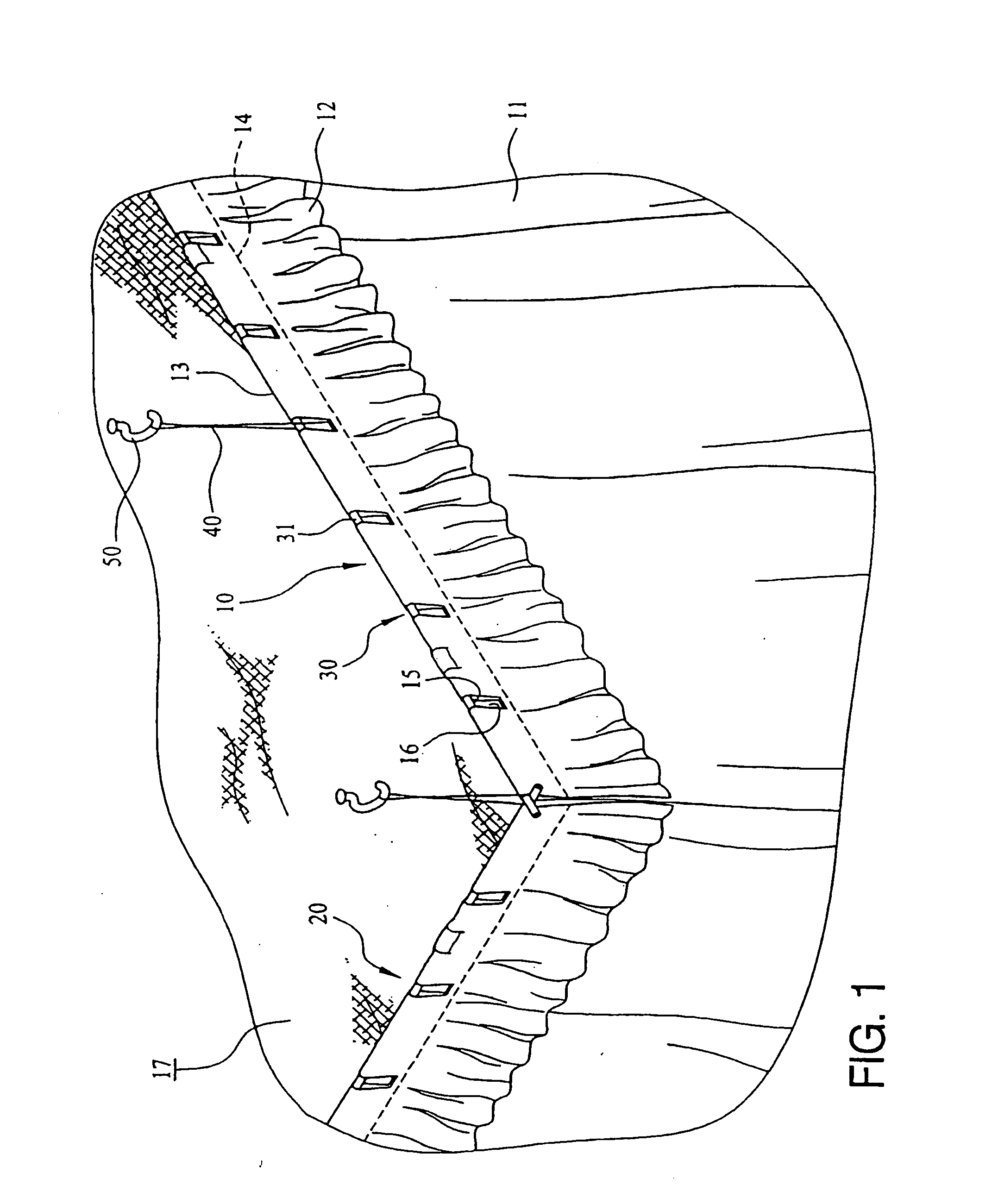 Mosquito net supporting frame structure and mosquito net arrangement