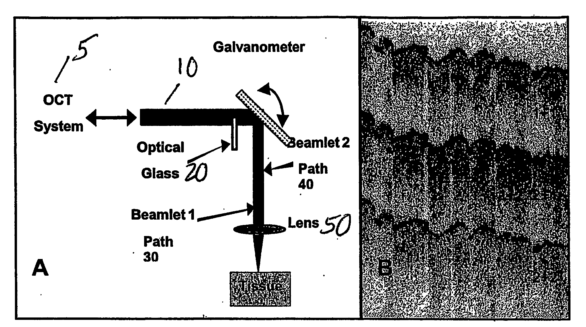 Speckle reduction in optical coherence tomography by path length encoded angular compounding