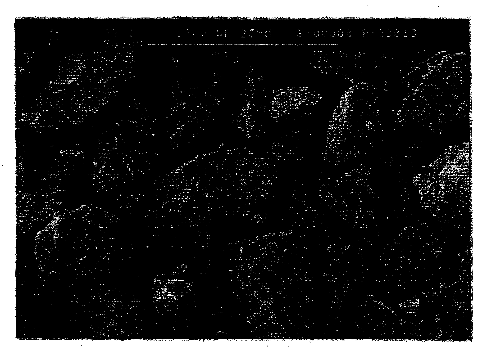 Method for Purification of Lactose