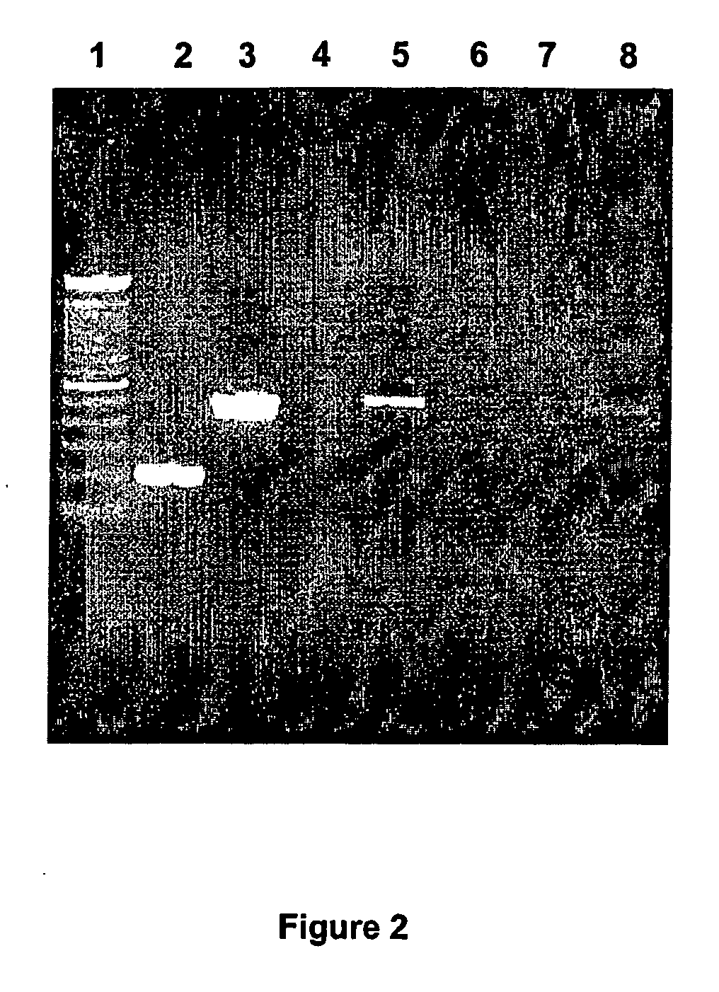 Method for isolating hepatocytes