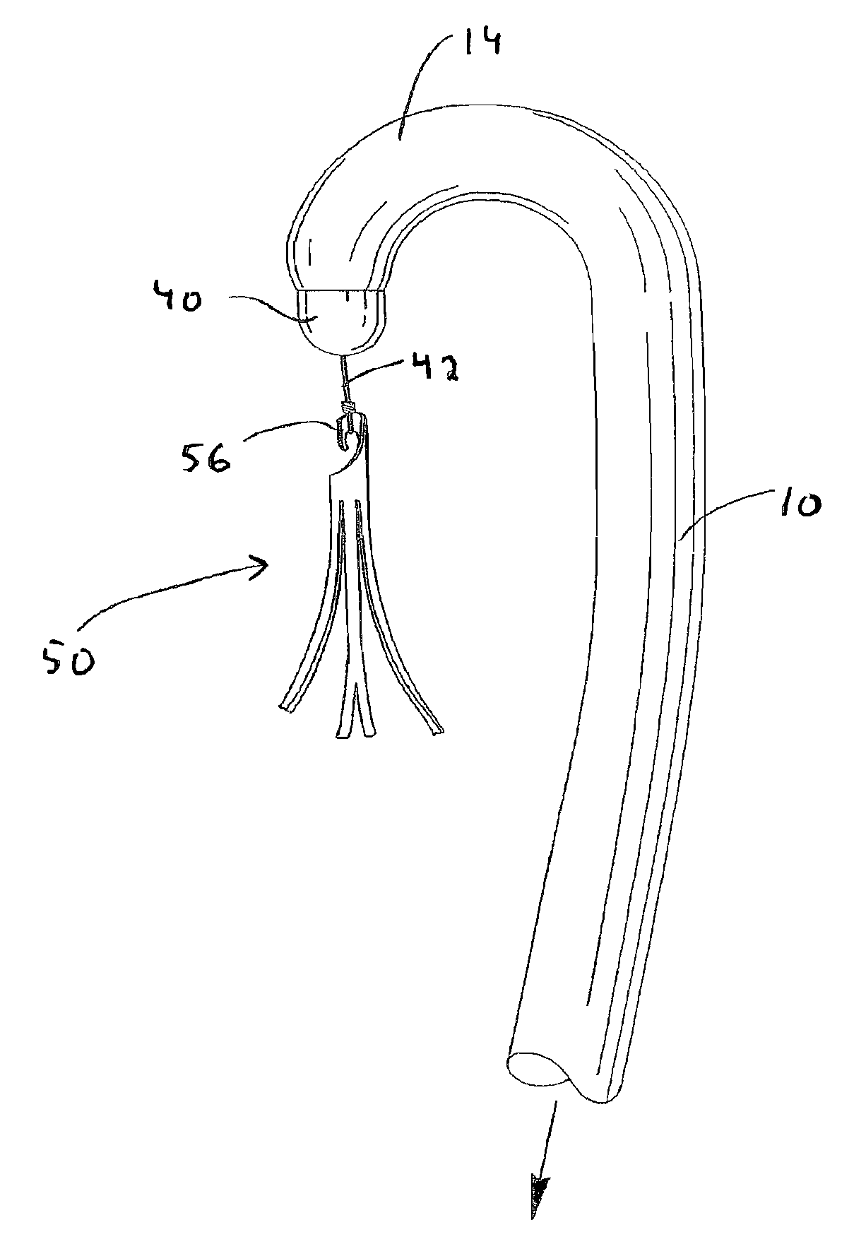 Method of removing a vein filter