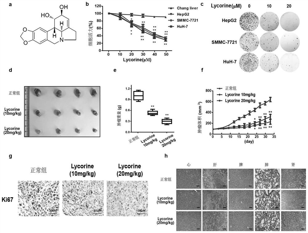 Application of the agent for reducing the expression or activity of lc-3b in the preparation of a drug that enhances lycorine's anti-liver cancer activity