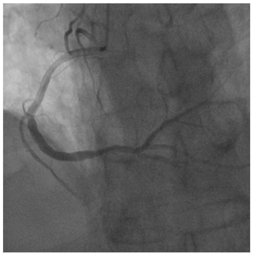 Method for Rapidly Constructing Cardiac Coronary Vessel Identification Dataset