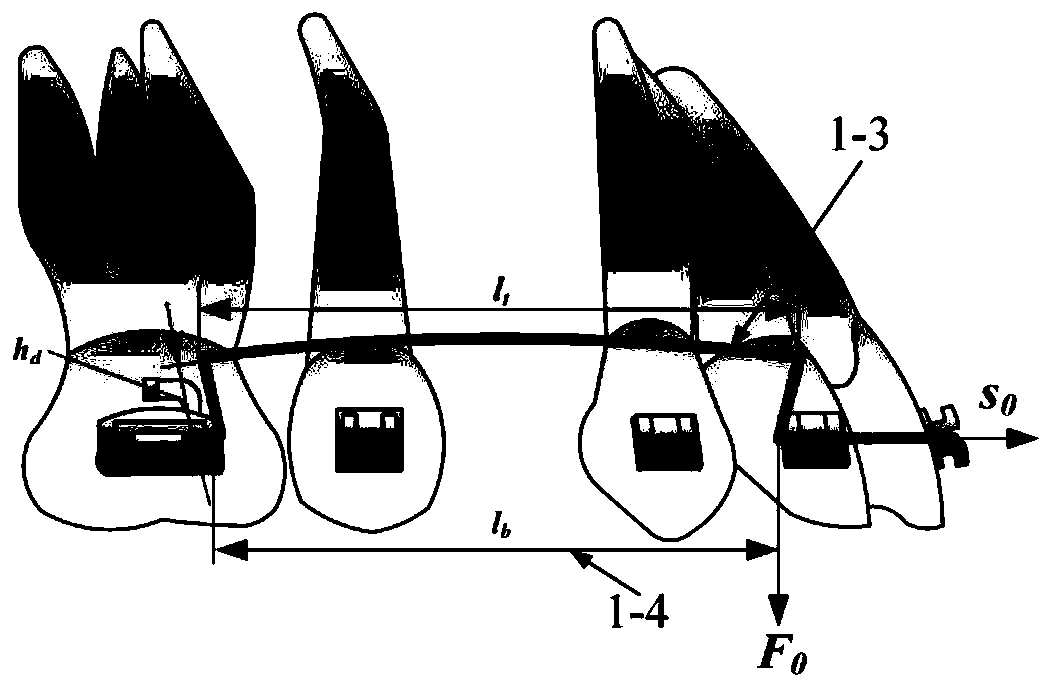 A Method for Establishing a Predictive Model of Tooth Rotation Angle in Auxiliary Arch for Depression