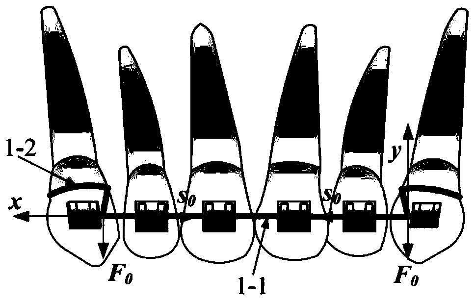 A Method for Establishing a Predictive Model of Tooth Rotation Angle in Auxiliary Arch for Depression