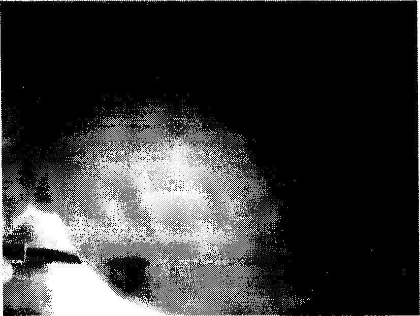 Method for reinforcing edge of medical picture