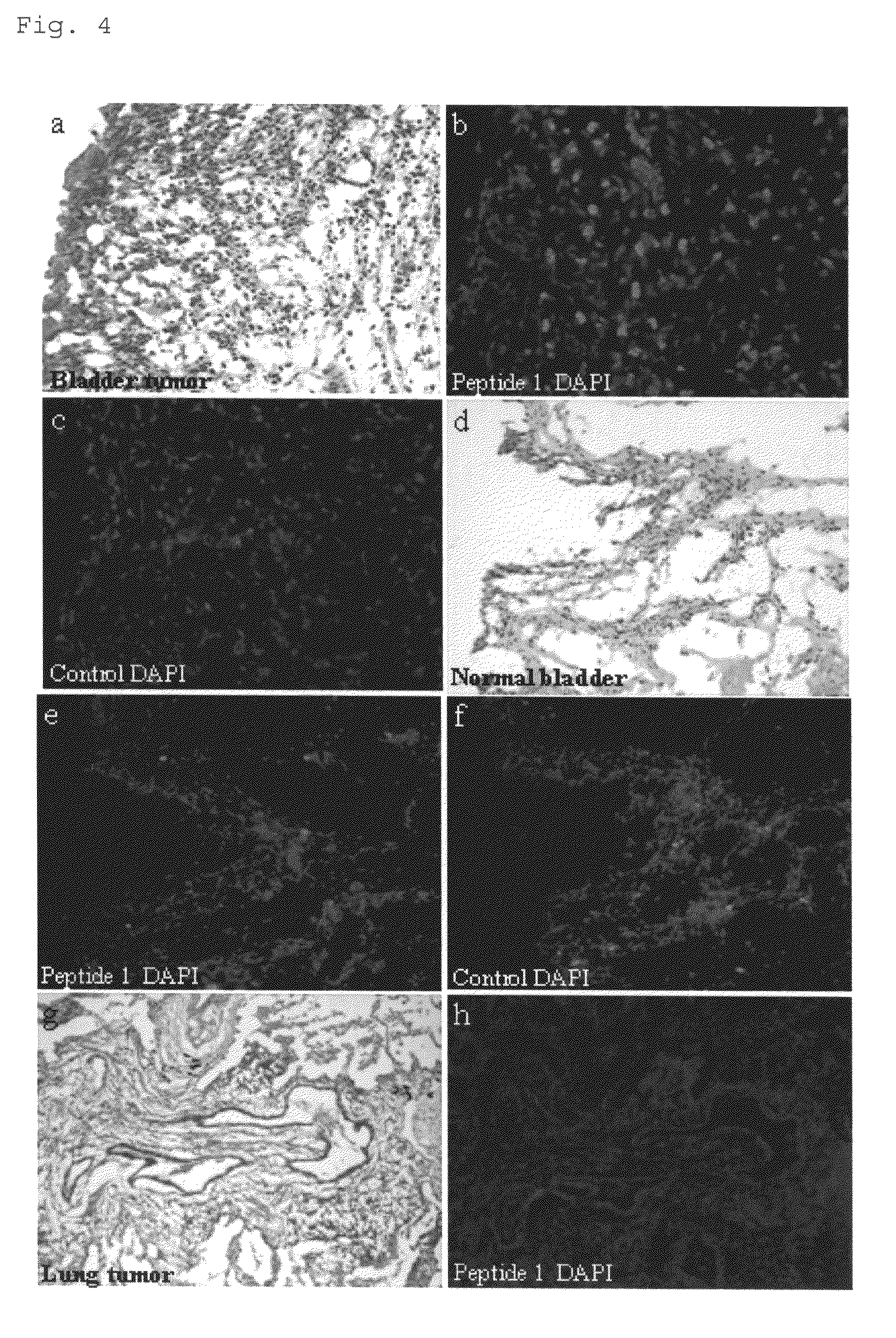 Bladder tumor-targeting peptide and use thereof