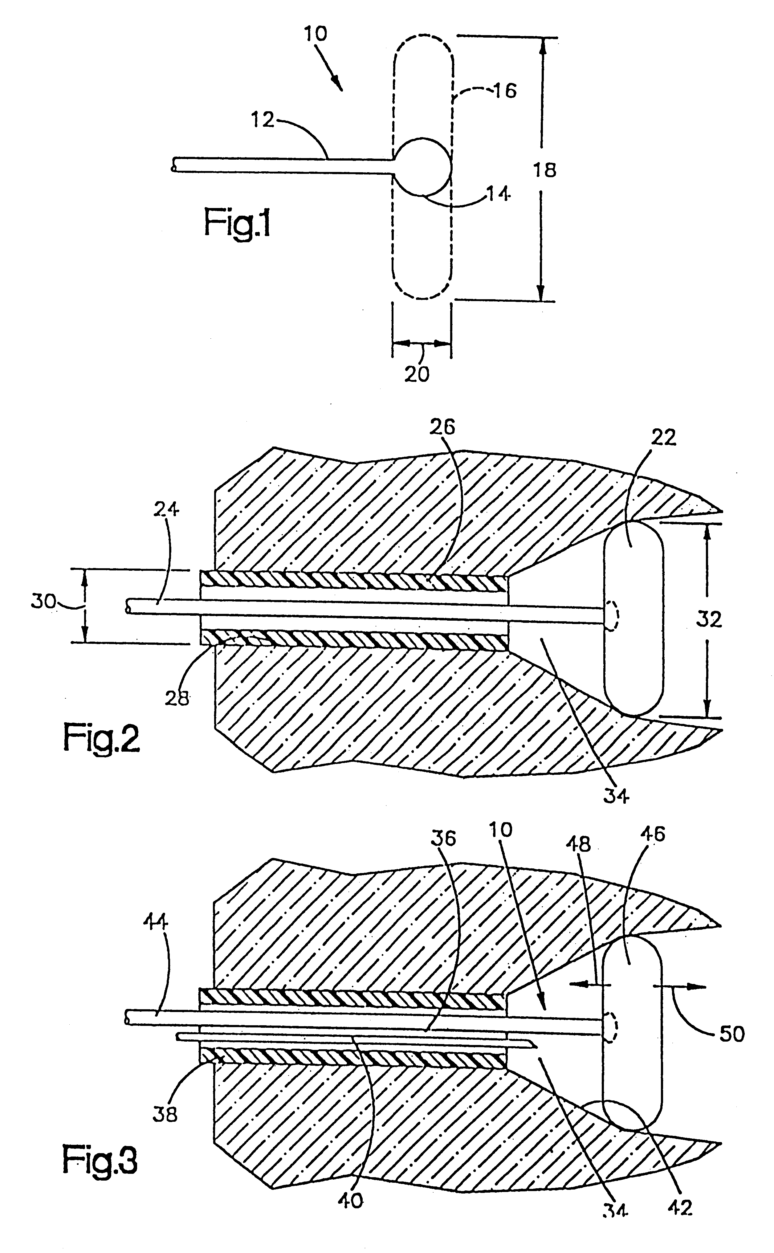 Method of dissecting tissue layers