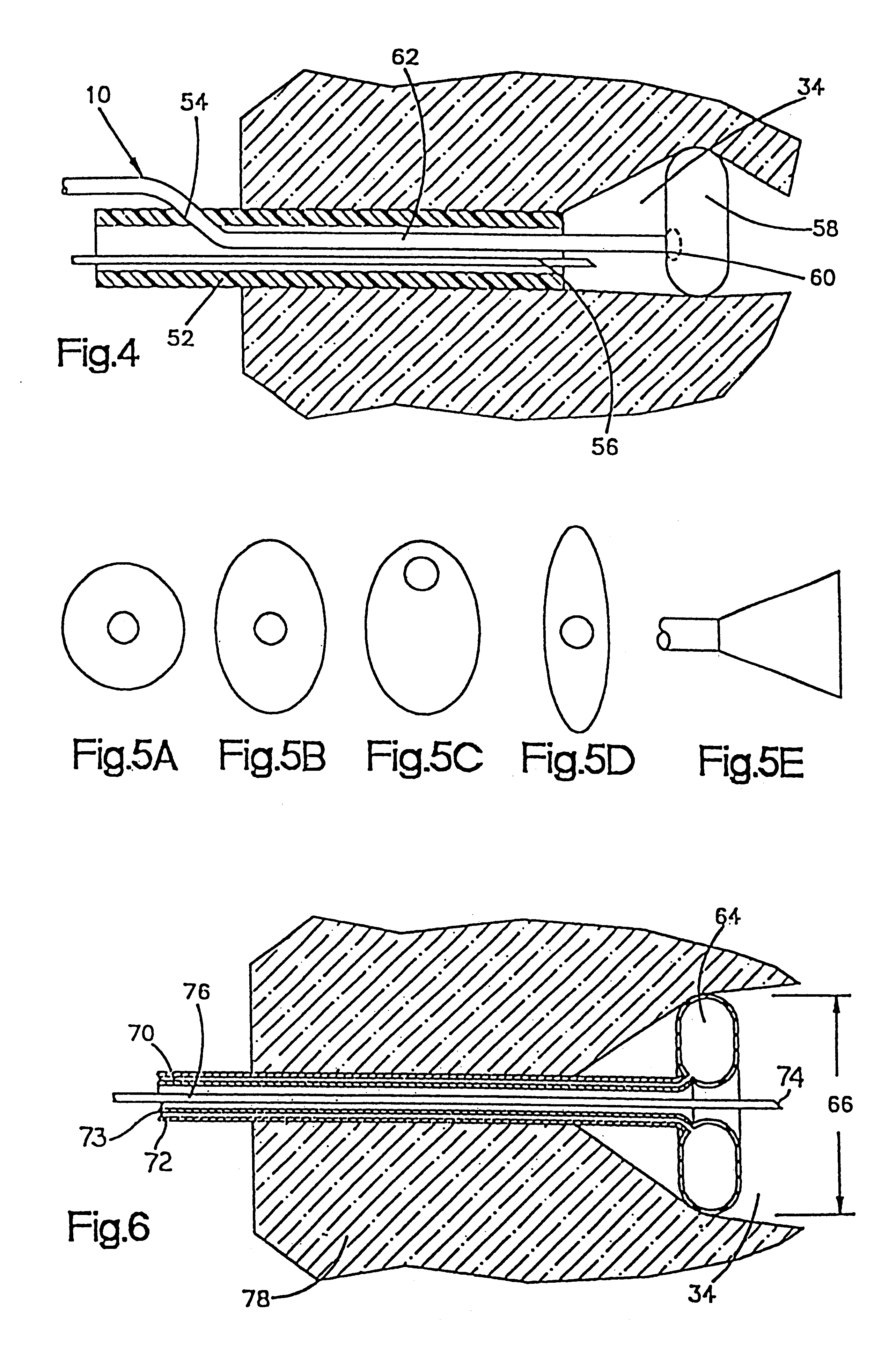 Method of dissecting tissue layers