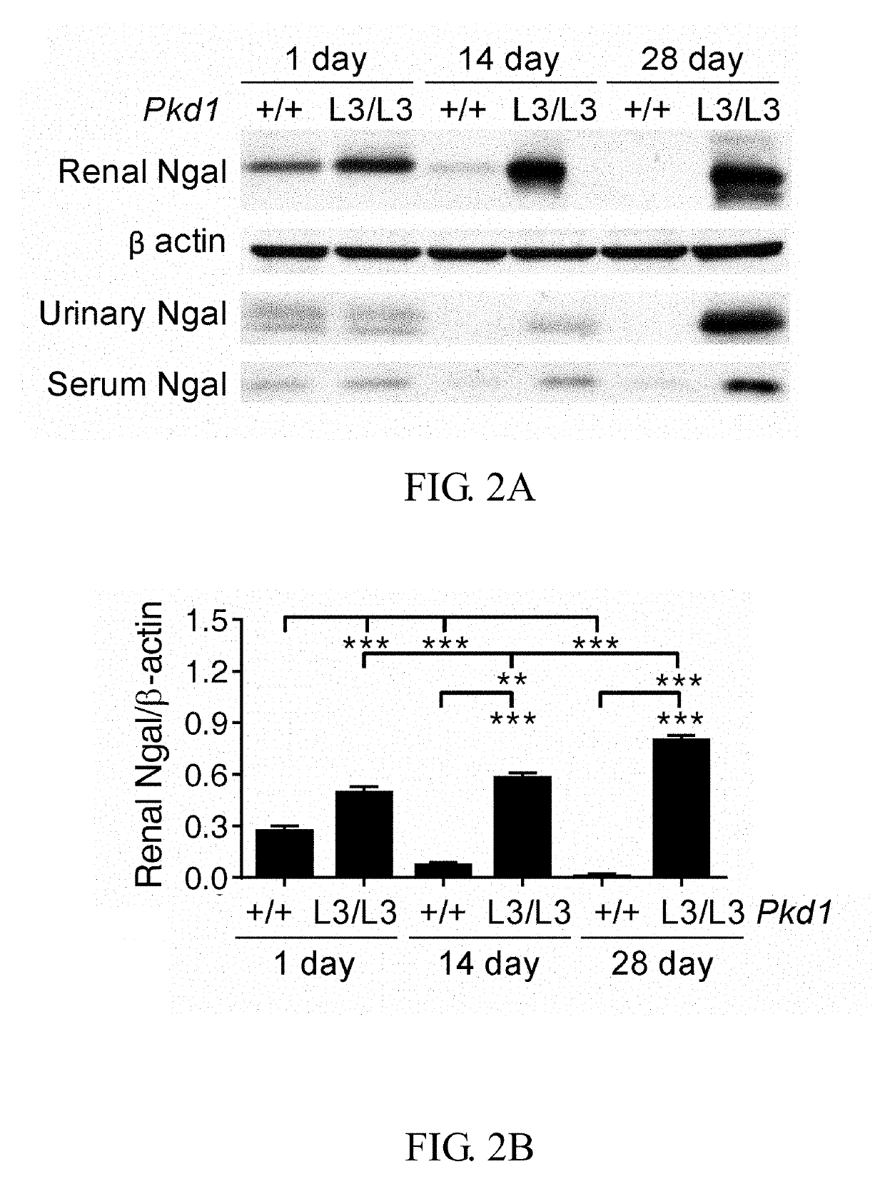 Method of preventing polycystic kidney disease and PKD animal model with exogenous neutrophil gelatinase-associated lipocalin