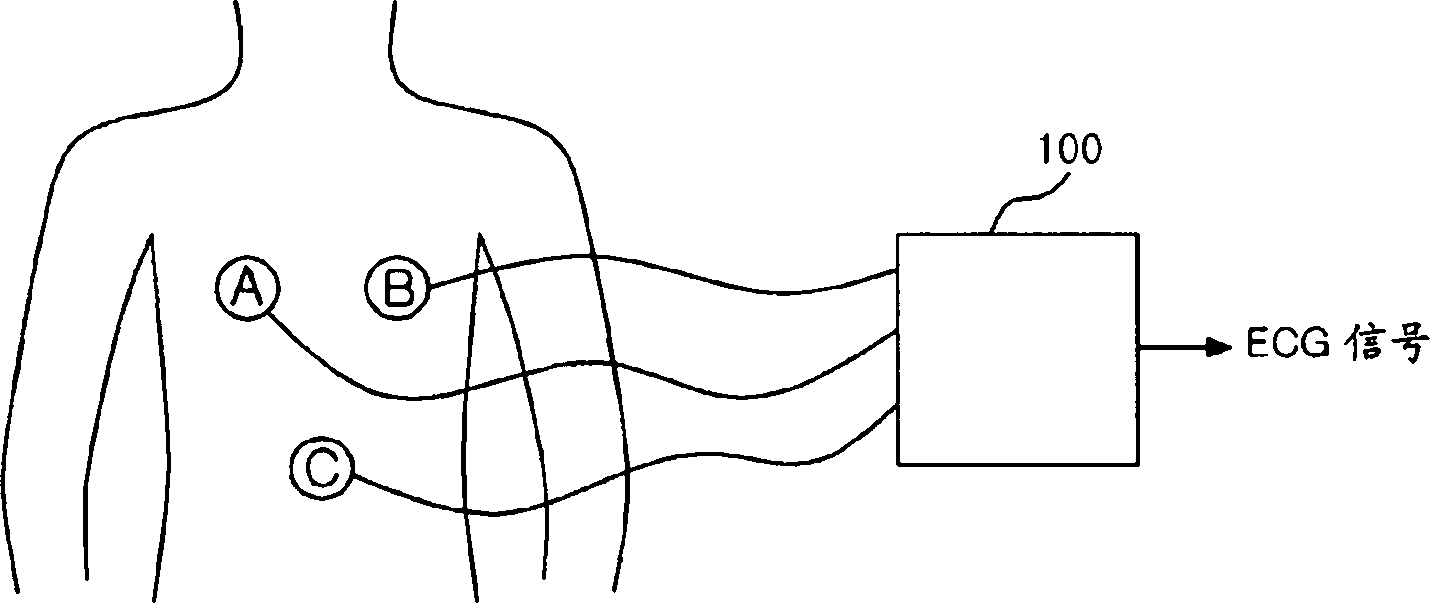 Multifunctional portable electrocardiogram measuring device capable of correcting an input signal and a signal correction method