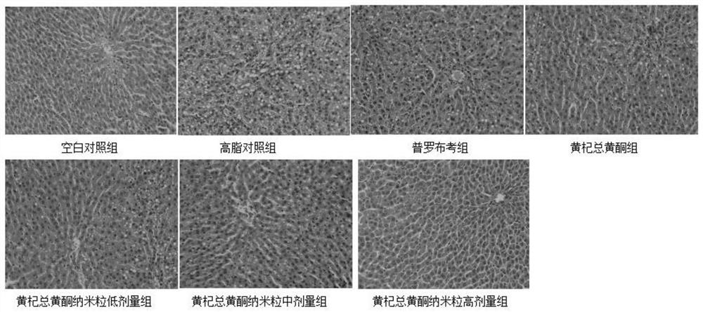 Application of chitosan engelhardia roxburghiana total flavone nanoparticles in preparation of medicines or health foods