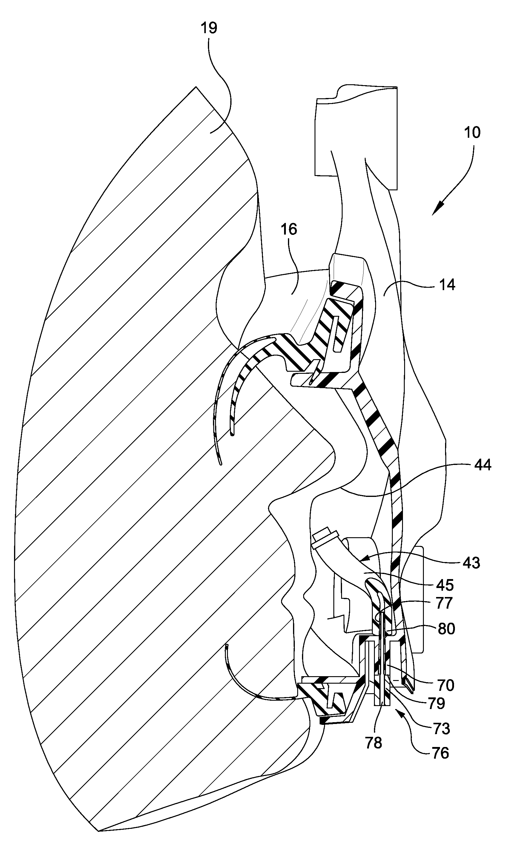 Supplemental gas delivery device for mask assembly