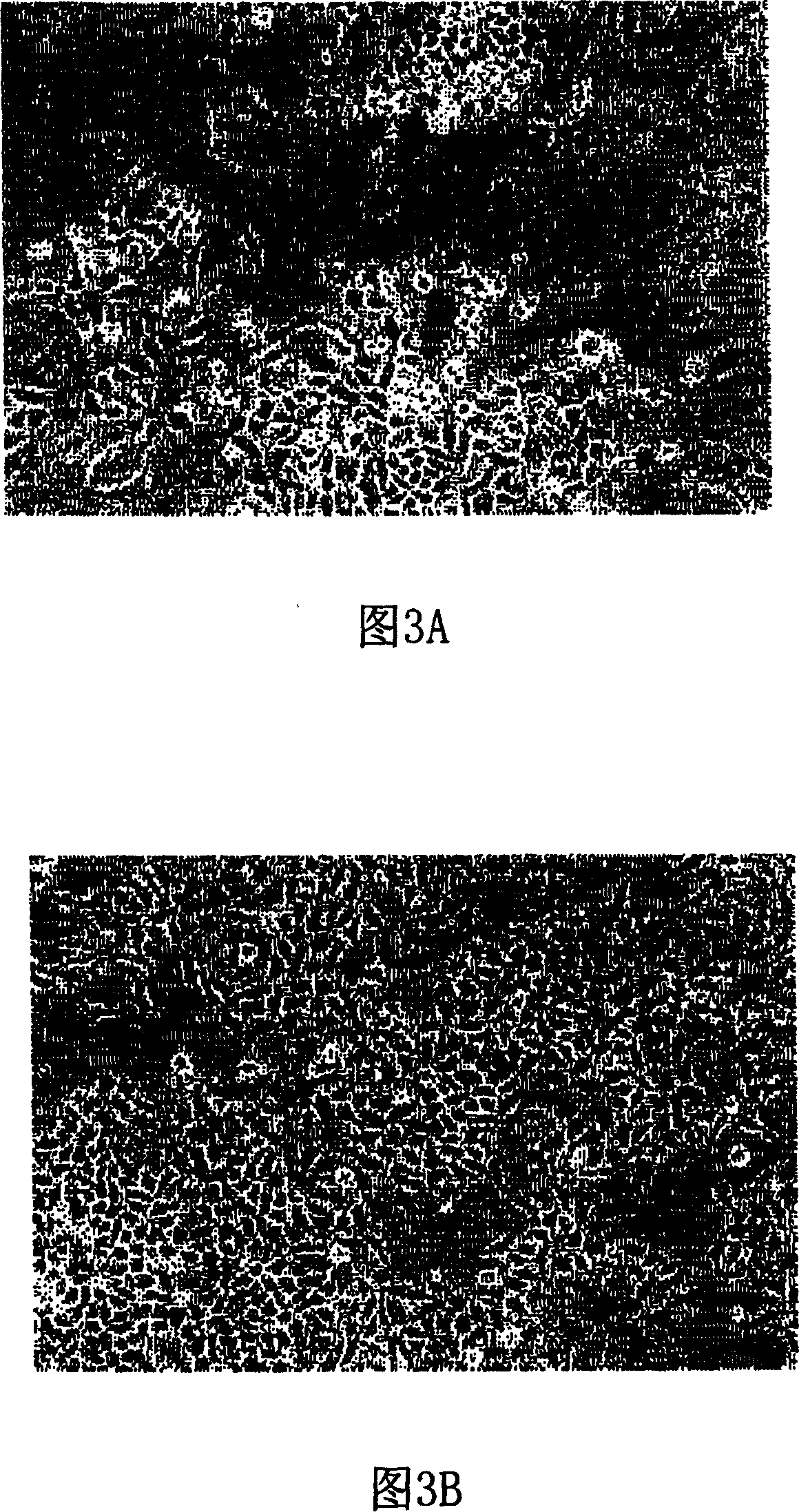 Trichosanthin suicide ENH-TCS, recombination vector and application thereof