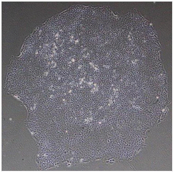 Method for inducing embryonic stem cell to be differentiated into corneal endothelial cells and inducing culture medium