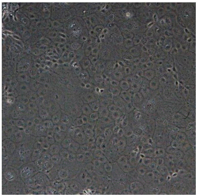 Method for inducing embryonic stem cell to be differentiated into corneal endothelial cells and inducing culture medium