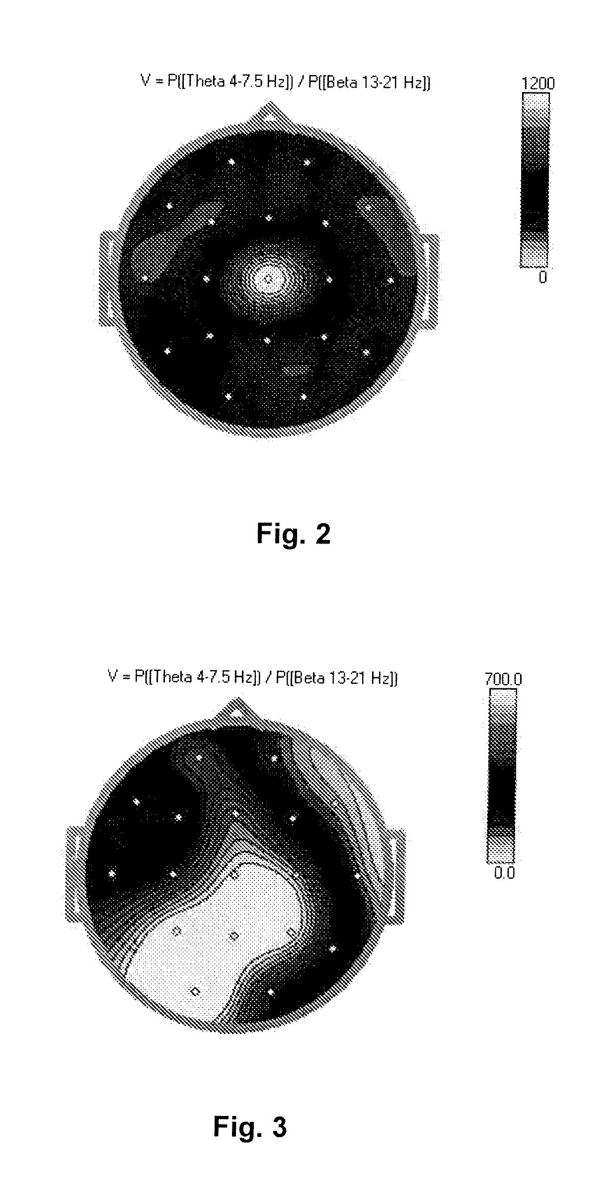 Oral delivery system for methylcobalamin to treat disorders