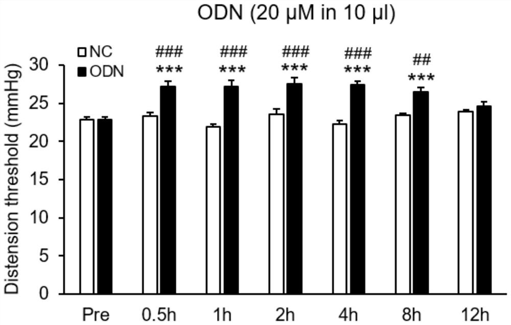 An oligodeoxyribonucleotide for alleviating chronic visceral hyperalgesia in irritable bowel syndrome