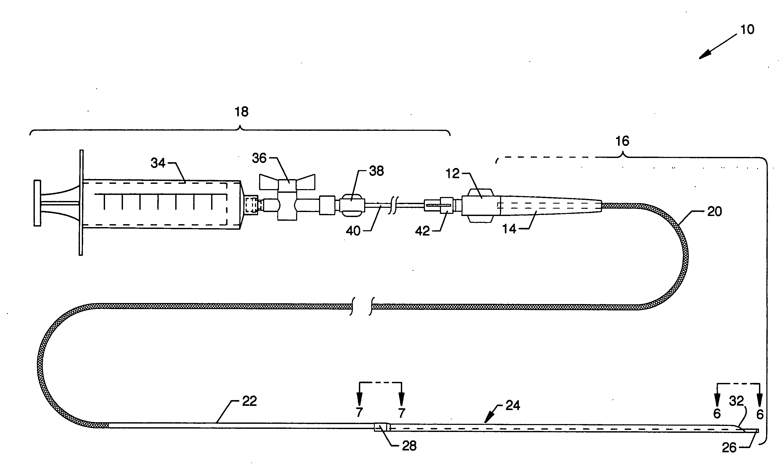 Dual lumen aspiration catheter system