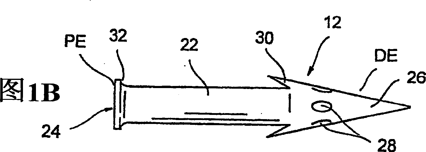 Methods and devices for draining fluids and lowering intraocular pressure