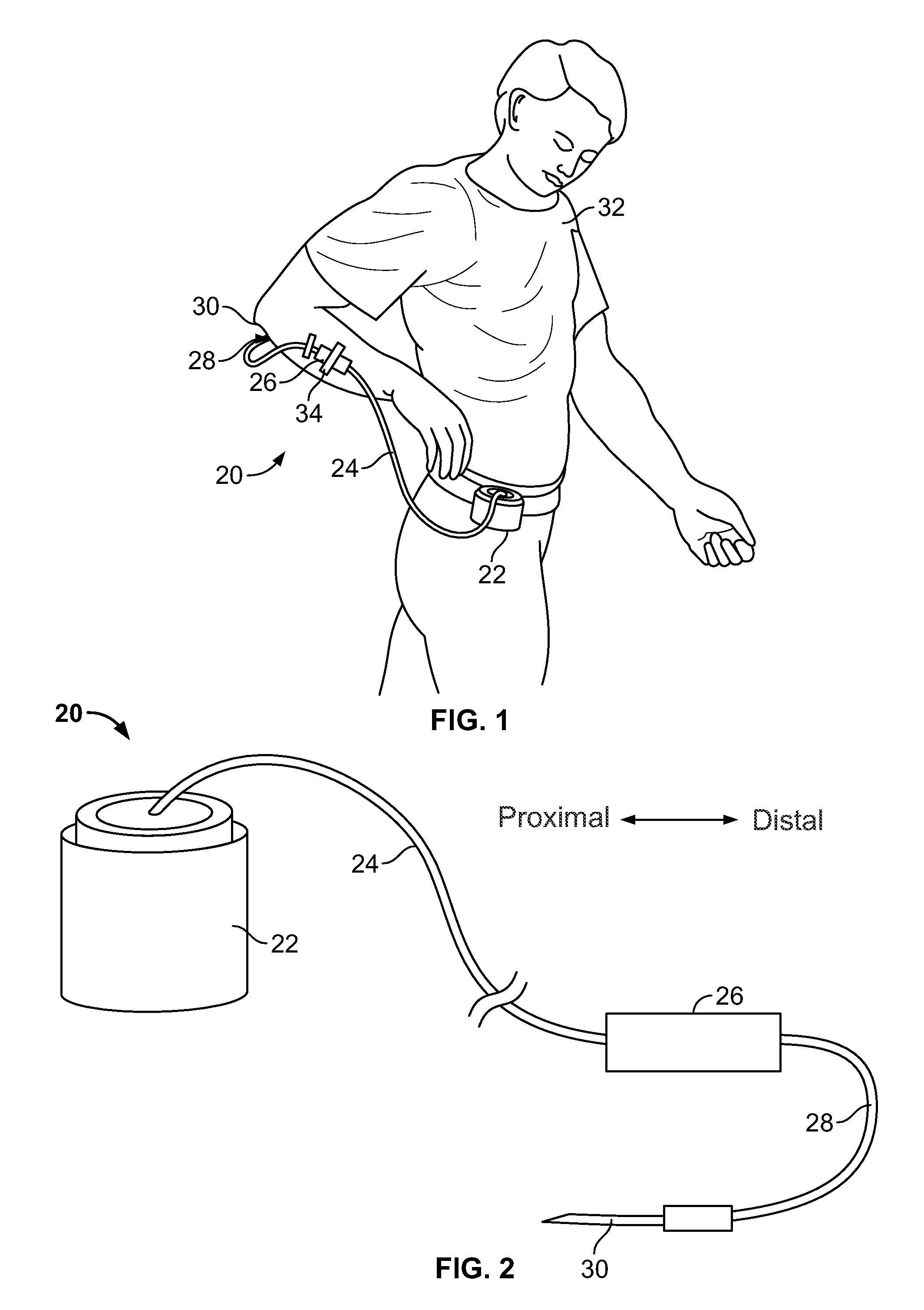 Fluid flow control system having capillary fluid flow restrictor