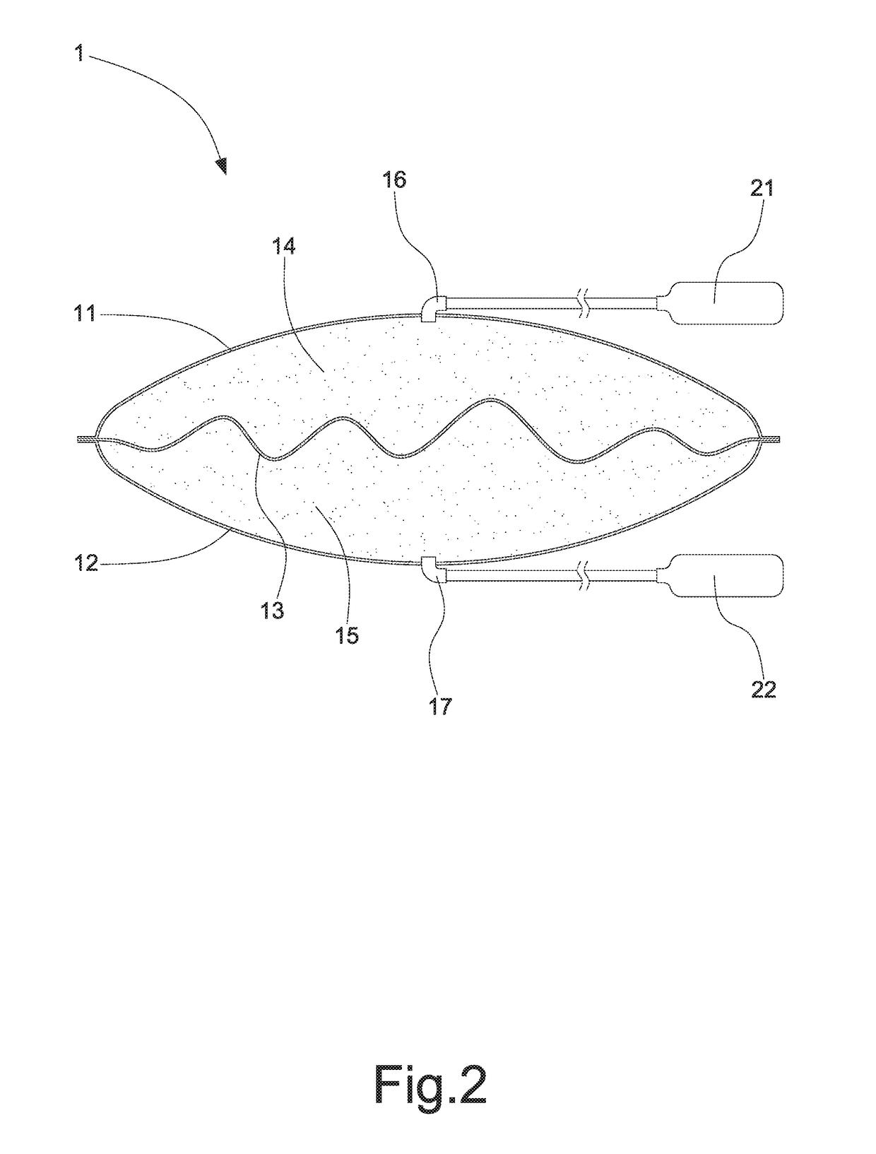 Air bag structure