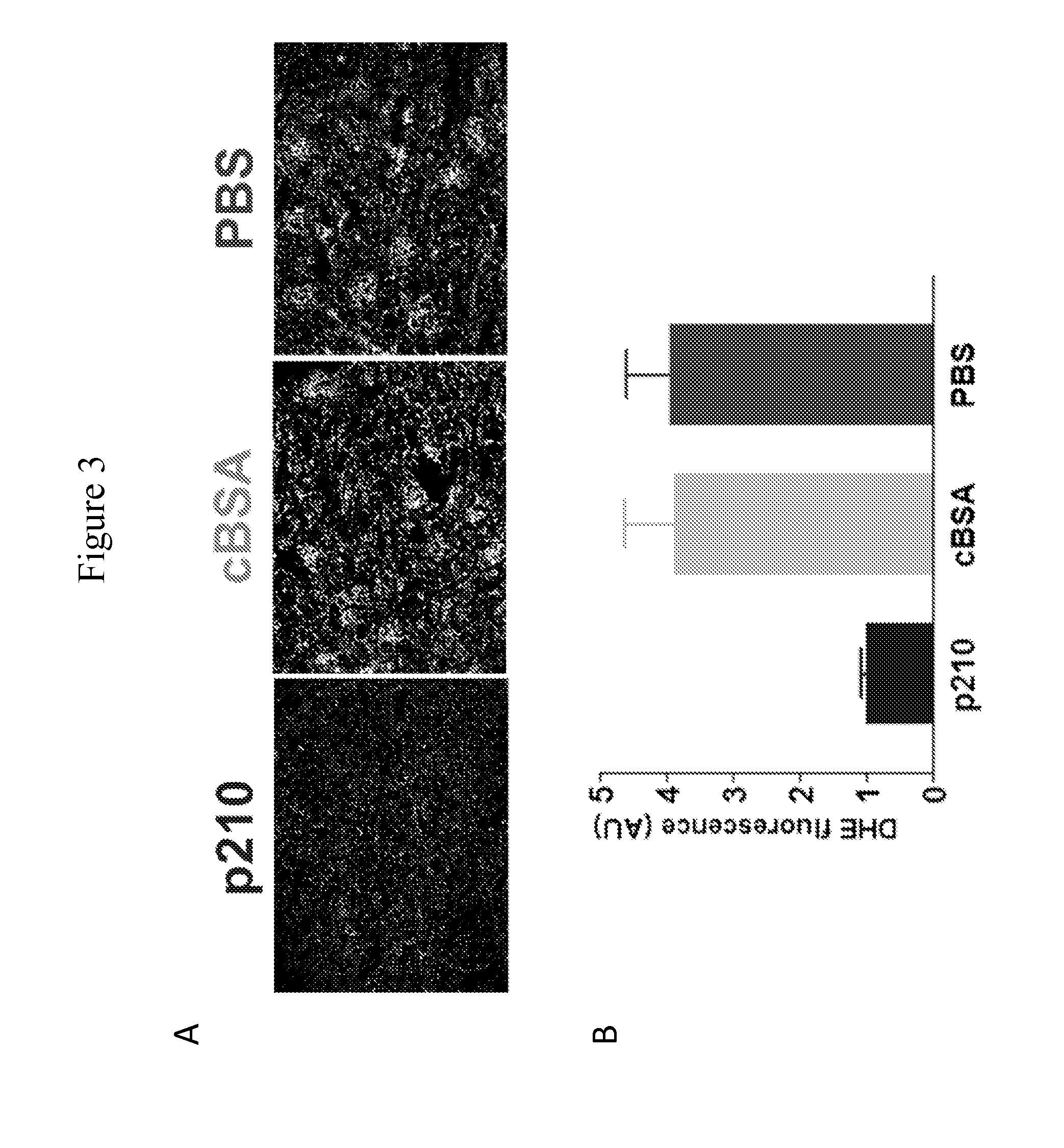 Methods for treating kidney disease with fragments of ApoB-100