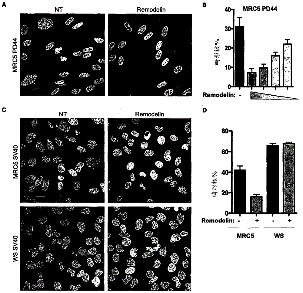 Nat10 modulators for treating or preventing laminopathies, aging and cancer