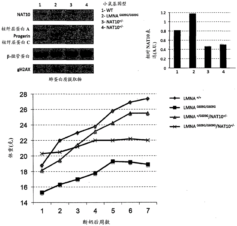 Nat10 modulators for treating or preventing laminopathies, aging and cancer