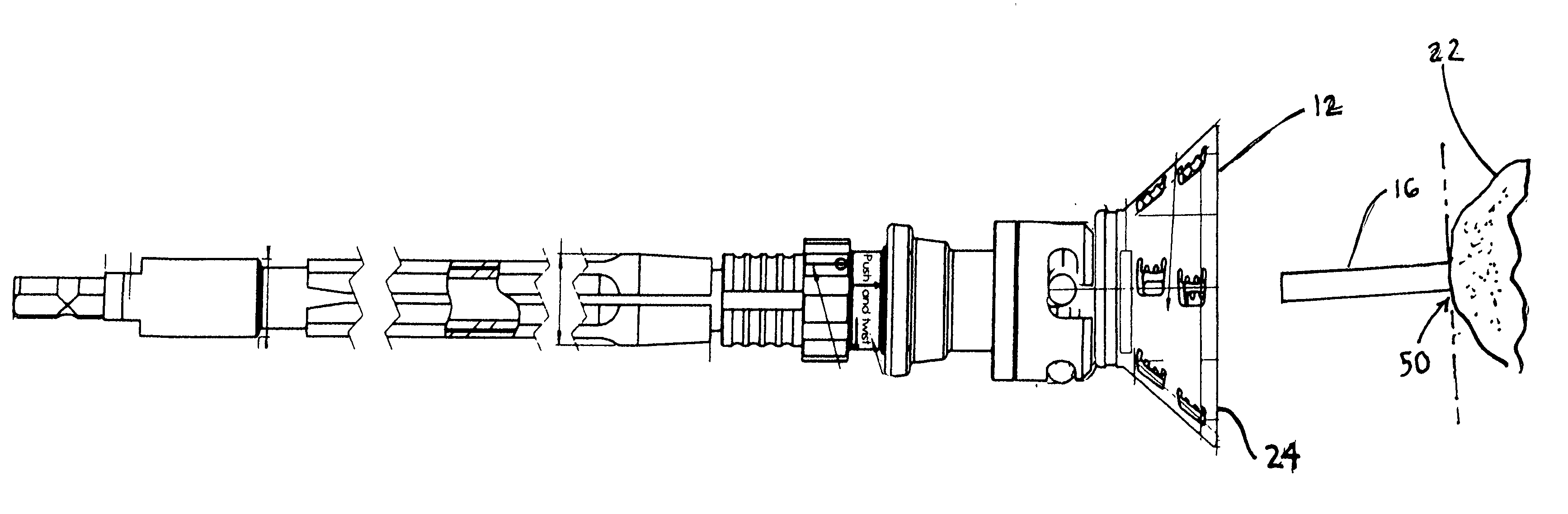 Guided reamer system for reshaping bone