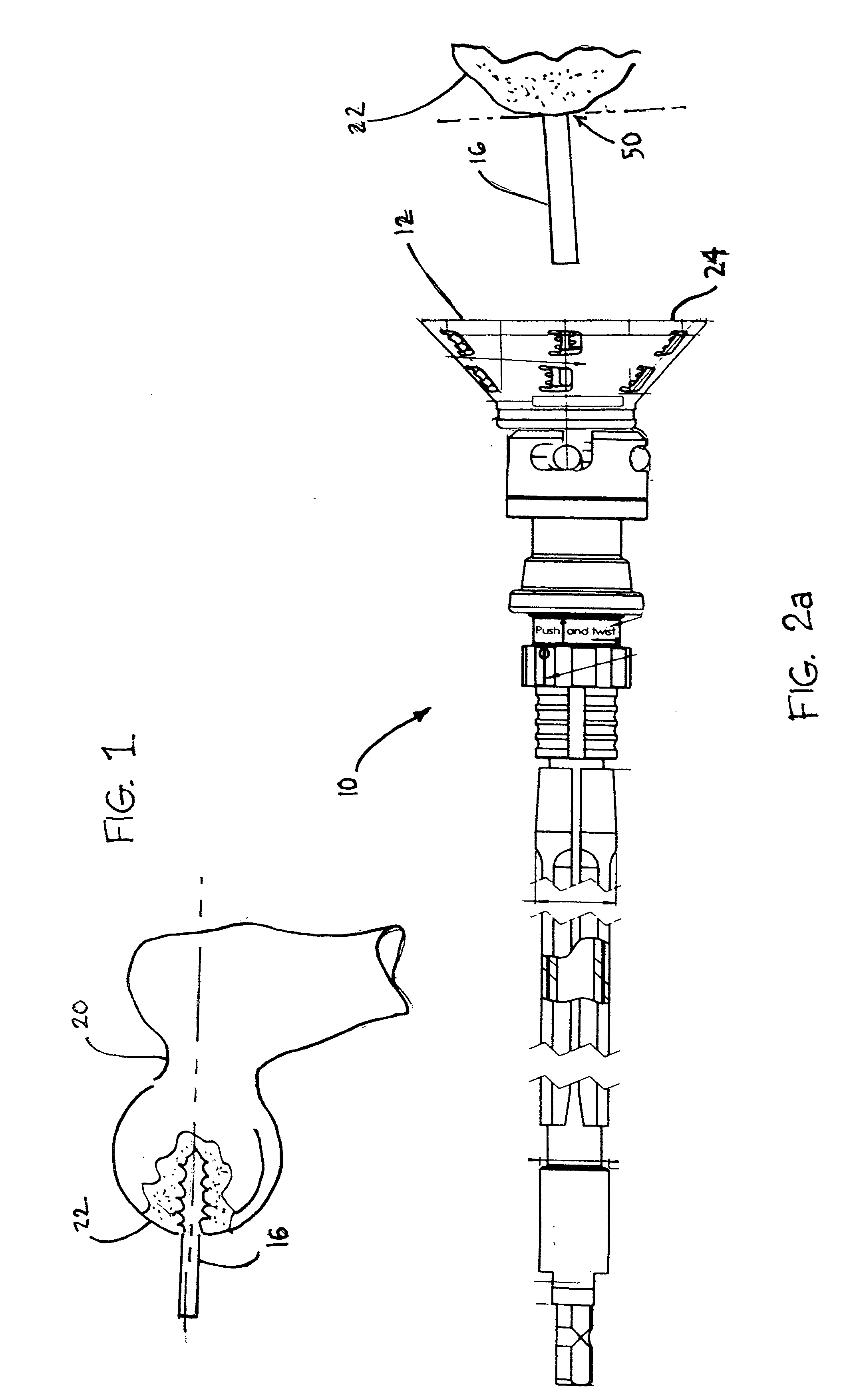 Guided reamer system for reshaping bone