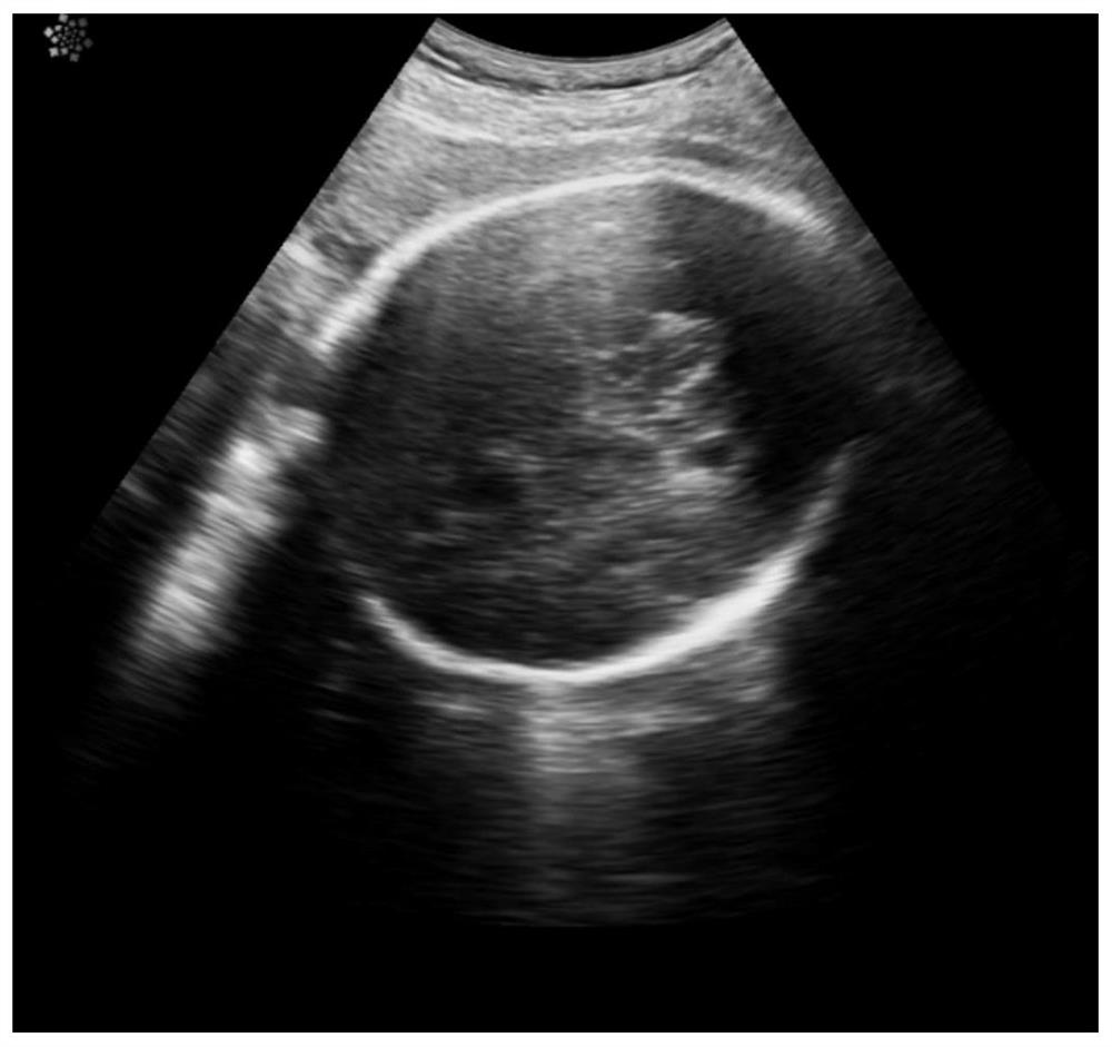 Method and device for measuring fetal head circumference in ultrasound images