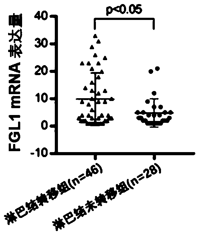 Application of FGL1 (fibrinogen like 1) in diagnosis and/or treatment on lymph node metastasis