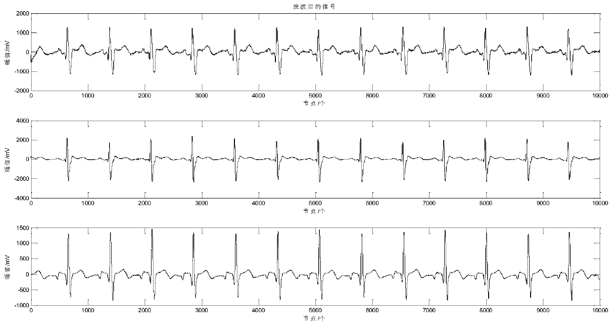 A P-Wave Extraction Method Based on Orthogonal Projection and Independent Component Analysis