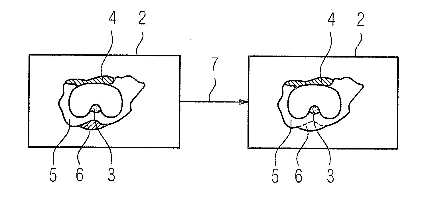 Method and magnetic resonance apparatus for correction of a b0 map for chemical shifts