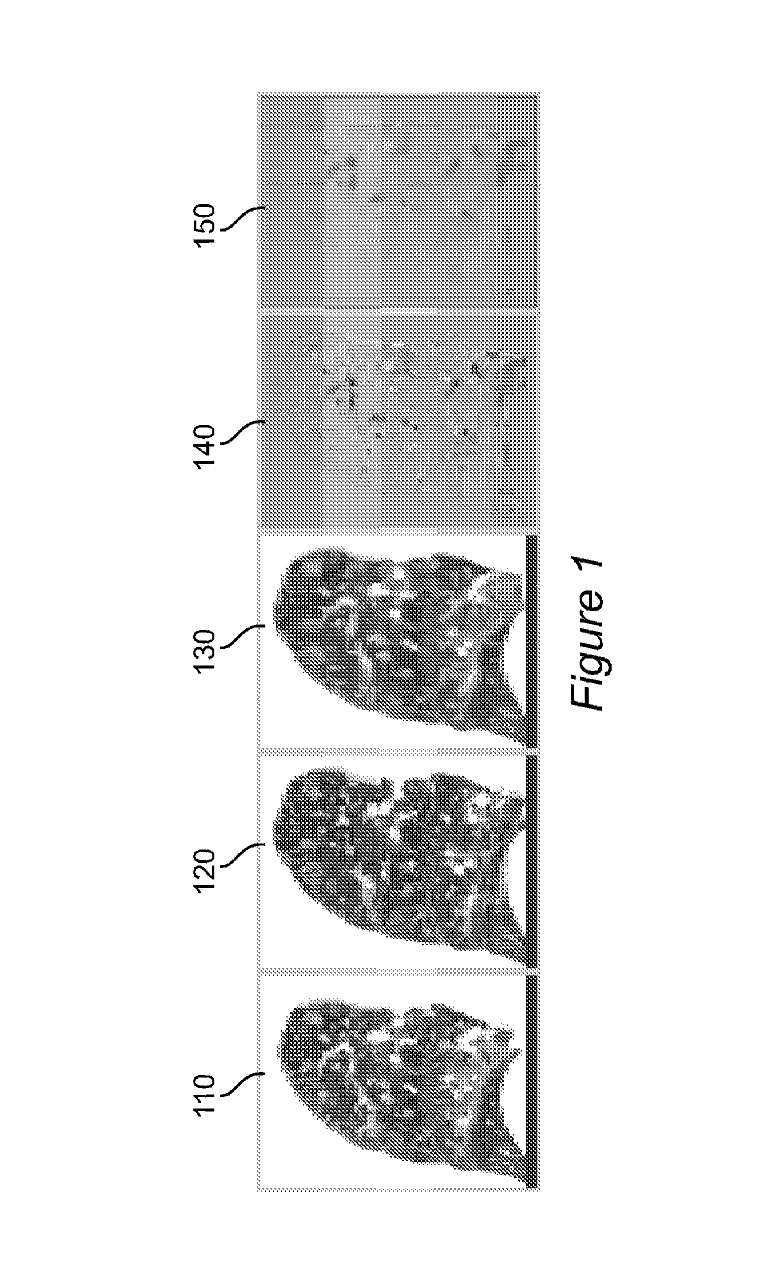 Method and system for using computed tomography to test pulmonary function