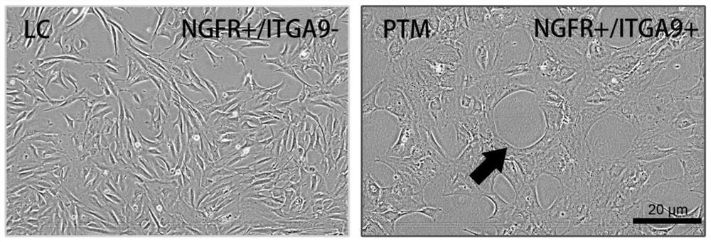 Biomarker of perimuscular cells of testicular tubes and application of biomarker