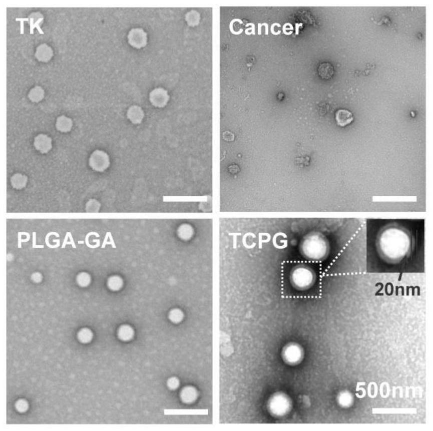 Preparation method and application of multifunctional bionic nano-drug