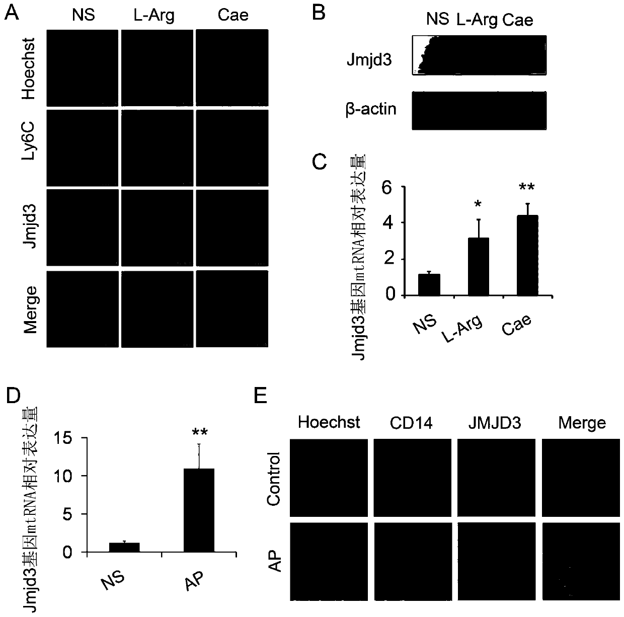 Use of JMJD3 inhibitor in preparing medicine for preventing and treating pancreatitis