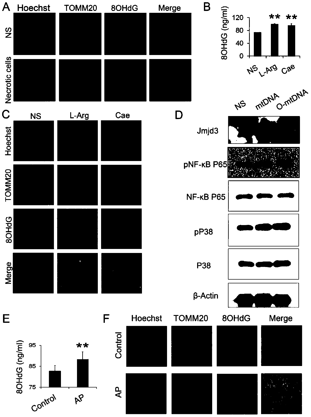 Use of JMJD3 inhibitor in preparing medicine for preventing and treating pancreatitis