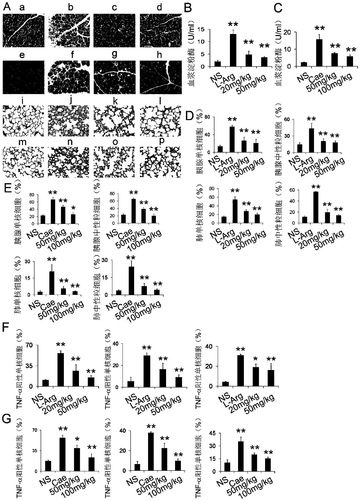 Use of JMJD3 inhibitor in preparing medicine for preventing and treating pancreatitis