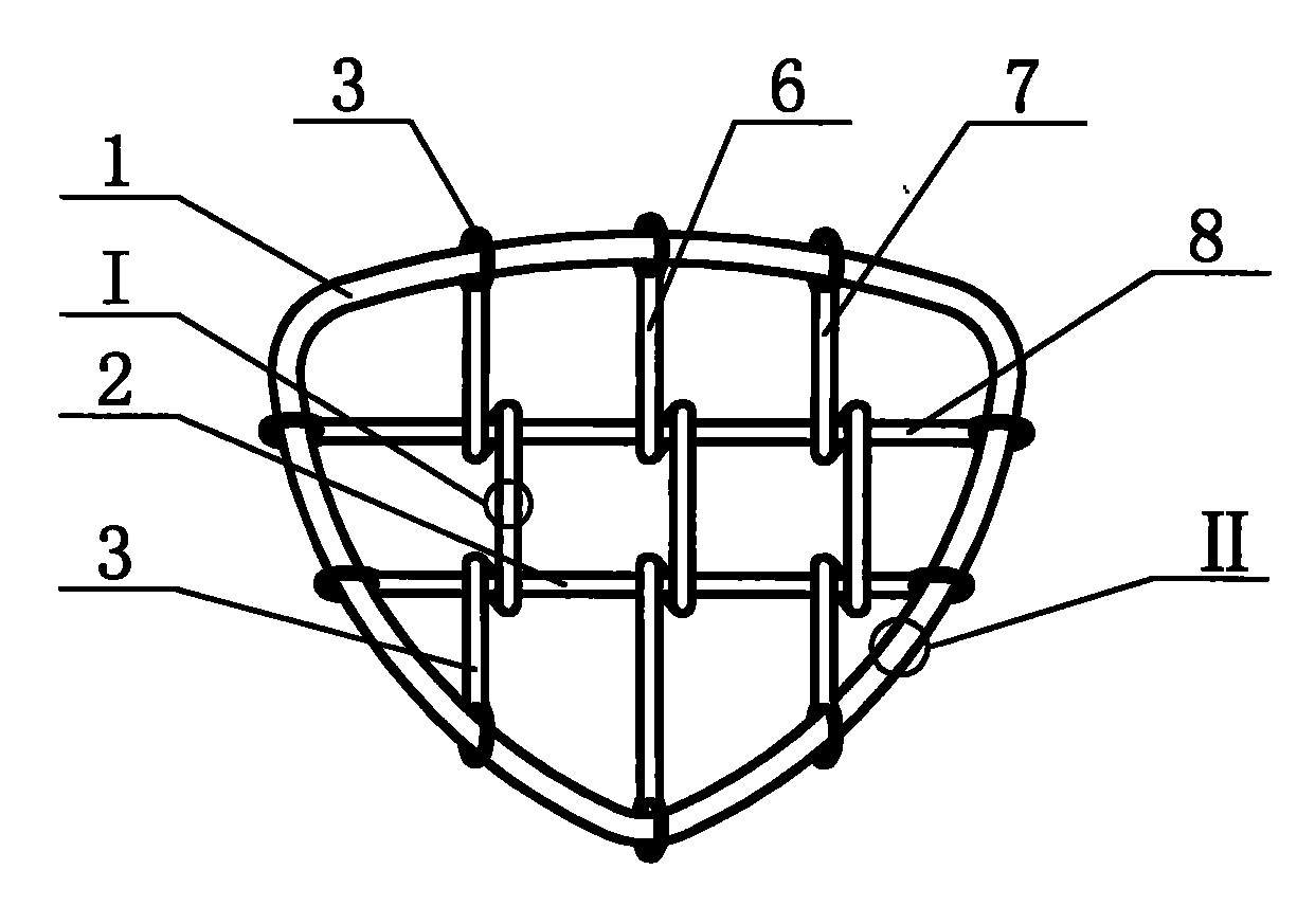 Grille intrauterine device