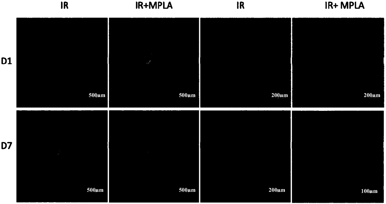 Application of MPLA in the preparation of drugs for prevention and treatment of testicular injury induced by ionizing radiation