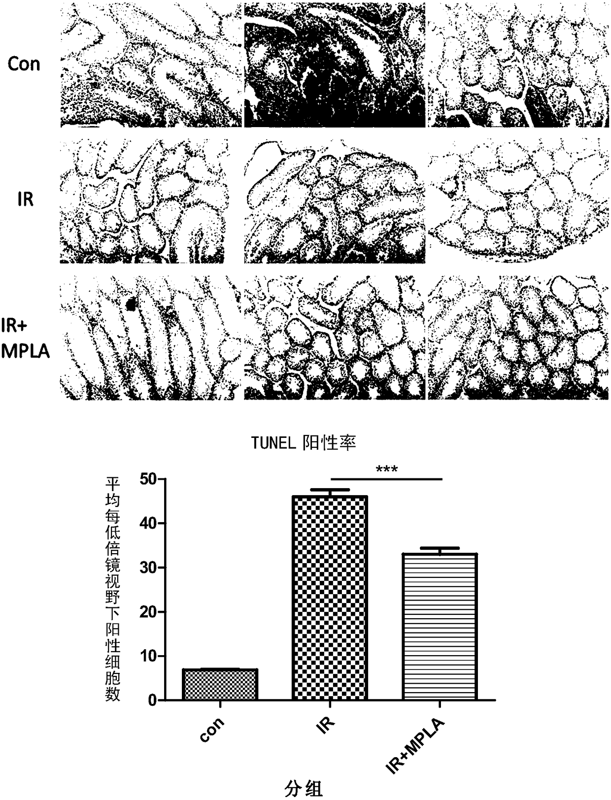 Application of MPLA in the preparation of drugs for prevention and treatment of testicular injury induced by ionizing radiation