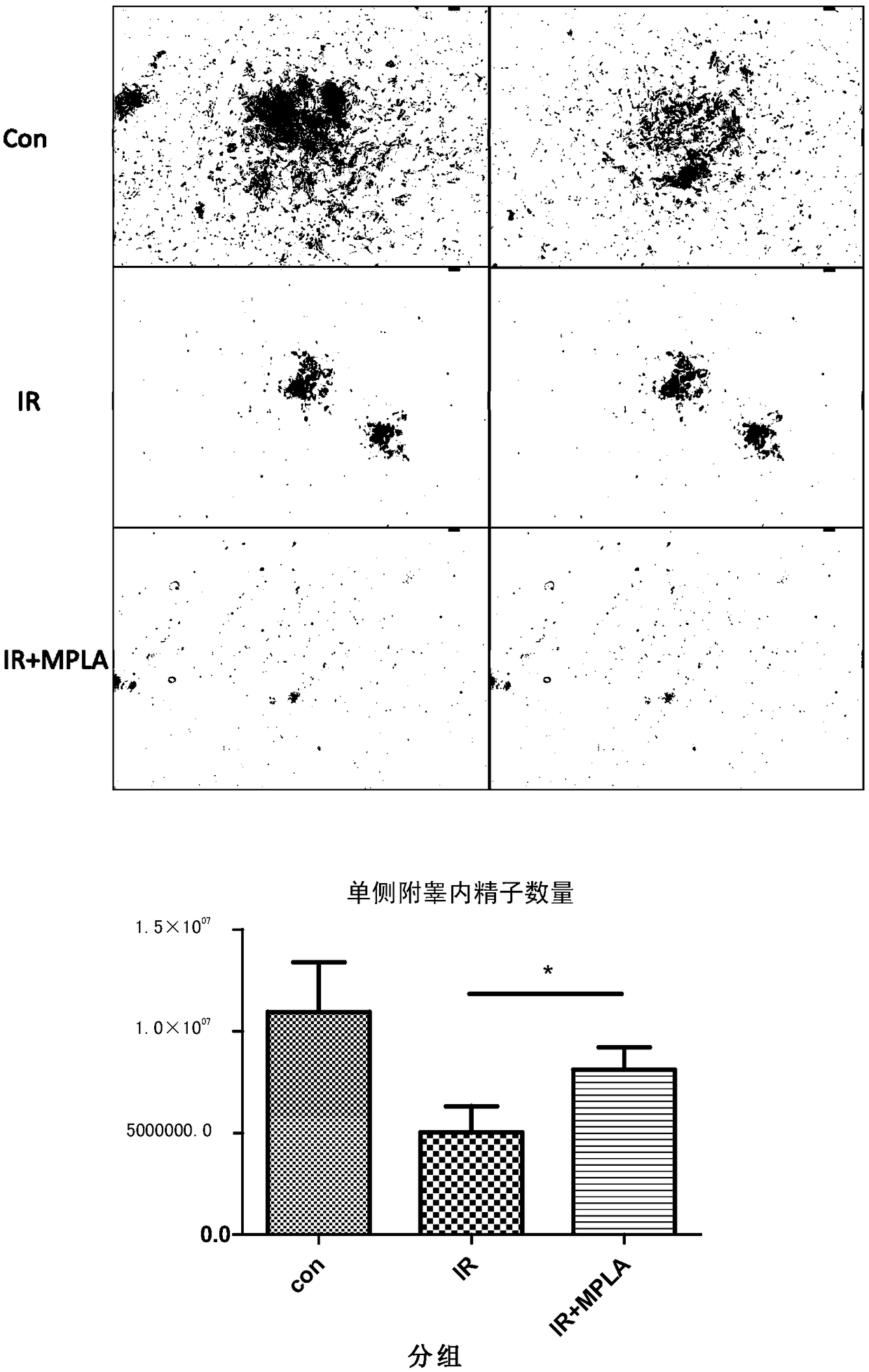 Application of MPLA in the preparation of drugs for prevention and treatment of testicular injury induced by ionizing radiation