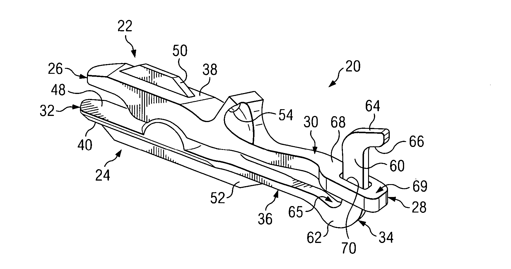 Posterior joint replacement device