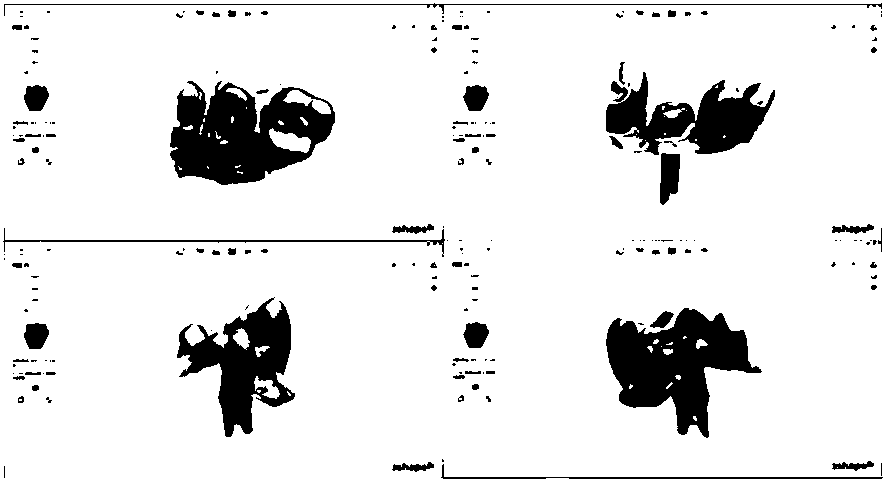 Gypsum-free novel digital post-core impression collection and model building technology