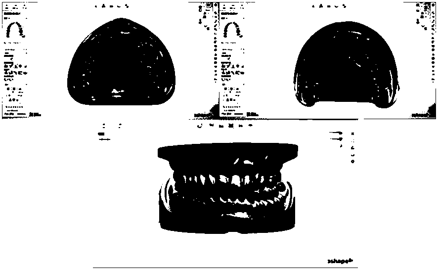 Gypsum-free novel digital post-core impression collection and model building technology