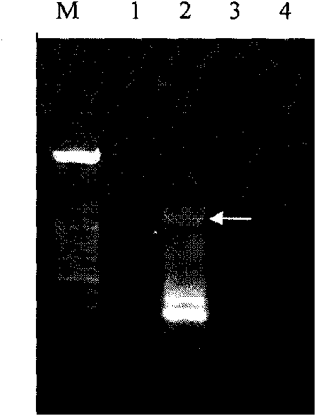 Plant yellow dwarf resistance-associated protein, coding gene and application thereof